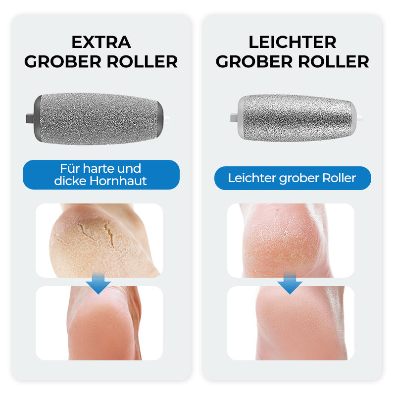 Elektrischer Hornhautentferner für die Füße