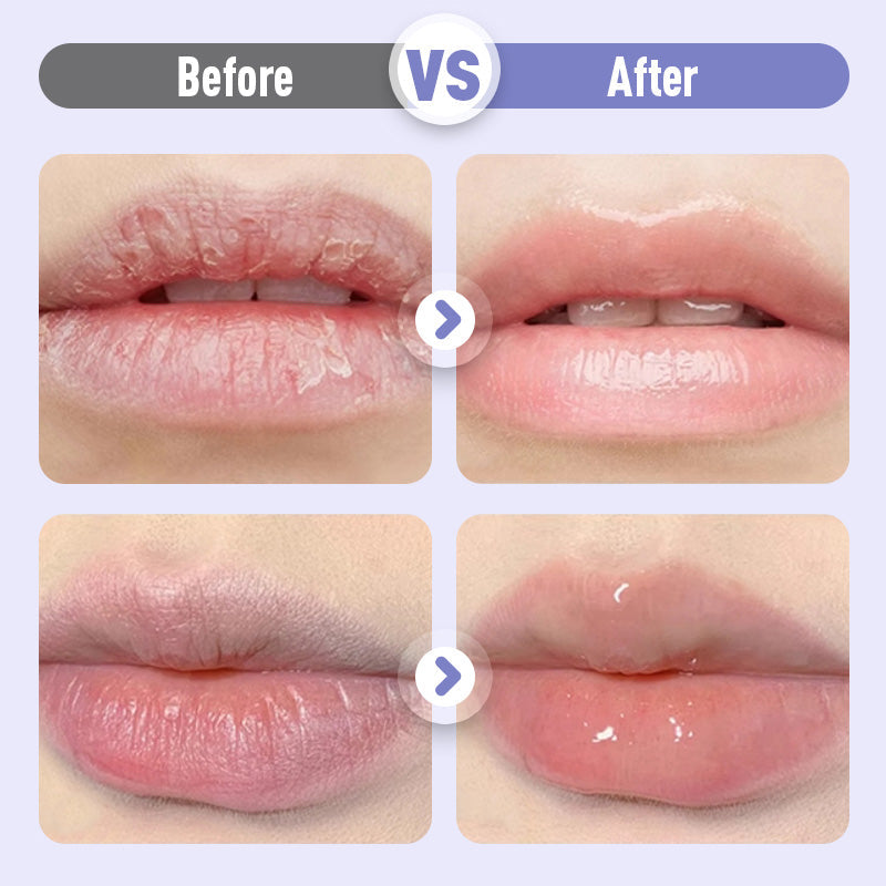 Aufpolsterndes und feuchtigkeitsspendendes Lippenserum gegen Falten