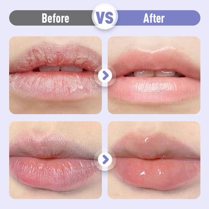 Aufpolsterndes und feuchtigkeitsspendendes Lippenserum gegen Falten